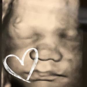 Meet your Posher, Shea